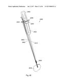 CERAMIC IMPLANT PLACEMENT SYSTEMS AND SUPERELASTIC SUTURE RETENTION LOOPS     FOR USE THEREWITH diagram and image