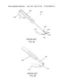 CERAMIC IMPLANT PLACEMENT SYSTEMS AND SUPERELASTIC SUTURE RETENTION LOOPS     FOR USE THEREWITH diagram and image