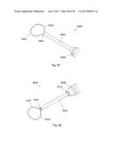 CERAMIC IMPLANT PLACEMENT SYSTEMS AND SUPERELASTIC SUTURE RETENTION LOOPS     FOR USE THEREWITH diagram and image