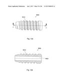 CERAMIC IMPLANT PLACEMENT SYSTEMS AND SUPERELASTIC SUTURE RETENTION LOOPS     FOR USE THEREWITH diagram and image