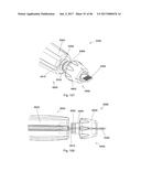 CERAMIC IMPLANT PLACEMENT SYSTEMS AND SUPERELASTIC SUTURE RETENTION LOOPS     FOR USE THEREWITH diagram and image