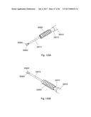 CERAMIC IMPLANT PLACEMENT SYSTEMS AND SUPERELASTIC SUTURE RETENTION LOOPS     FOR USE THEREWITH diagram and image