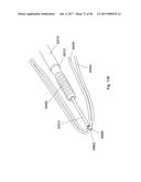 CERAMIC IMPLANT PLACEMENT SYSTEMS AND SUPERELASTIC SUTURE RETENTION LOOPS     FOR USE THEREWITH diagram and image