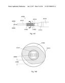 CERAMIC IMPLANT PLACEMENT SYSTEMS AND SUPERELASTIC SUTURE RETENTION LOOPS     FOR USE THEREWITH diagram and image