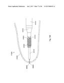 CERAMIC IMPLANT PLACEMENT SYSTEMS AND SUPERELASTIC SUTURE RETENTION LOOPS     FOR USE THEREWITH diagram and image