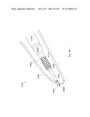 CERAMIC IMPLANT PLACEMENT SYSTEMS AND SUPERELASTIC SUTURE RETENTION LOOPS     FOR USE THEREWITH diagram and image