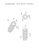 CERAMIC IMPLANT PLACEMENT SYSTEMS AND SUPERELASTIC SUTURE RETENTION LOOPS     FOR USE THEREWITH diagram and image