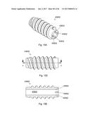 CERAMIC IMPLANT PLACEMENT SYSTEMS AND SUPERELASTIC SUTURE RETENTION LOOPS     FOR USE THEREWITH diagram and image