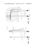 SUTURE PASSER SYSTEMS AND METHODS FOR TONGUE OR OTHER TISSUE SUSPENSION     AND COMPRESSION diagram and image