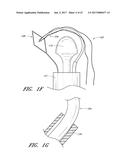 SUTURE PASSER SYSTEMS AND METHODS FOR TONGUE OR OTHER TISSUE SUSPENSION     AND COMPRESSION diagram and image