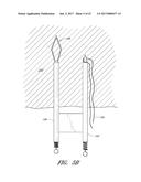 SUTURE PASSER SYSTEMS AND METHODS FOR TONGUE OR OTHER TISSUE SUSPENSION     AND COMPRESSION diagram and image