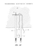 SUTURE PASSER SYSTEMS AND METHODS FOR TONGUE OR OTHER TISSUE SUSPENSION     AND COMPRESSION diagram and image