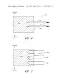 SUTURE PASSER SYSTEMS AND METHODS FOR TONGUE OR OTHER TISSUE SUSPENSION     AND COMPRESSION diagram and image