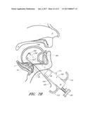 SUTURE PASSER SYSTEMS AND METHODS FOR TONGUE OR OTHER TISSUE SUSPENSION     AND COMPRESSION diagram and image