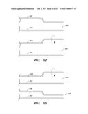 SUTURE PASSER SYSTEMS AND METHODS FOR TONGUE OR OTHER TISSUE SUSPENSION     AND COMPRESSION diagram and image