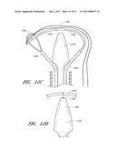 SUTURE PASSER SYSTEMS AND METHODS FOR TONGUE OR OTHER TISSUE SUSPENSION     AND COMPRESSION diagram and image