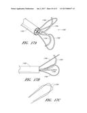 SUTURE PASSER SYSTEMS AND METHODS FOR TONGUE OR OTHER TISSUE SUSPENSION     AND COMPRESSION diagram and image