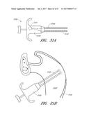 SUTURE PASSER SYSTEMS AND METHODS FOR TONGUE OR OTHER TISSUE SUSPENSION     AND COMPRESSION diagram and image