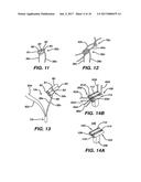 SURGICAL FILAMENT SNARE ASSEMBLIES diagram and image