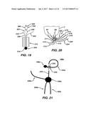 SURGICAL FILAMENT SNARE ASSEMBLIES diagram and image