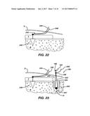 SURGICAL FILAMENT SNARE ASSEMBLIES diagram and image