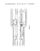 Electrical Surgical Instrument with One-Handed Operation diagram and image