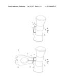 SURGICAL INSTRUMENT FOR FITTING AN OSTEOSYNTHESIS CLIP diagram and image