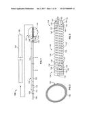 Implant System and Delivery Method diagram and image