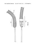 Implant System and Delivery Method diagram and image