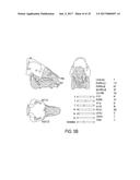 CRANIAL REFERENCE MOUNT diagram and image