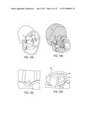 CRANIAL REFERENCE MOUNT diagram and image