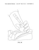 DEVICES AND METHODS FOR VERTEBROSTENTING diagram and image