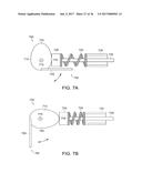 DEVICES AND METHODS FOR VERTEBROSTENTING diagram and image