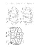 HYBRID HEART VALVES ADAPTED FOR POST-IMPLANT EXPANSION diagram and image