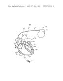 LEFT SIDE SINGLE PASS LEAD FOR LA AND LV SENSING AND PACING diagram and image