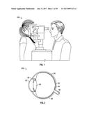 METHODS AND SYSTEMS FOR PERFORMING CONFOCAL MICROSCOPY diagram and image