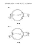 METHODS AND SYSTEMS FOR PERFORMING CONFOCAL MICROSCOPY diagram and image