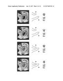 ULTRASONIC DIAGNOSTIC APPARATUS AND MEDICAL IMAGE PROCESSING APPARATUS diagram and image