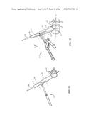 SURGICAL INSTRUMENTATION AND METHOD diagram and image