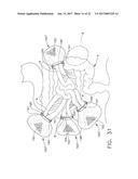 SURGICAL BOWEL RETRACTOR DEVICES diagram and image