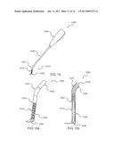 ABRASIVE CUTTING SURGICAL INSTRUMENT diagram and image