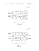 DIRECT FABRICATION OF ORTHODONTIC APPLIANCES WITH VARIABLE PROPERTIES diagram and image