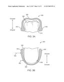 DIRECT FABRICATION OF ORTHODONTIC APPLIANCES WITH VARIABLE PROPERTIES diagram and image