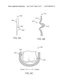 DIRECT FABRICATION OF ORTHODONTIC APPLIANCES WITH VARIABLE PROPERTIES diagram and image