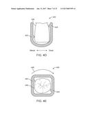 DIRECT FABRICATION OF ORTHODONTIC APPLIANCES WITH VARIABLE PROPERTIES diagram and image