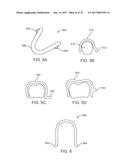 DIRECT FABRICATION OF ORTHODONTIC APPLIANCES WITH VARIABLE PROPERTIES diagram and image