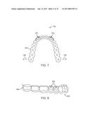 DIRECT FABRICATION OF ORTHODONTIC APPLIANCES WITH VARIABLE PROPERTIES diagram and image