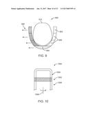 DIRECT FABRICATION OF ORTHODONTIC APPLIANCES WITH VARIABLE PROPERTIES diagram and image