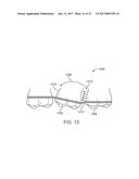 DIRECT FABRICATION OF ORTHODONTIC APPLIANCES WITH VARIABLE PROPERTIES diagram and image