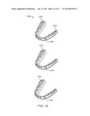 DIRECT FABRICATION OF ORTHODONTIC APPLIANCES WITH VARIABLE PROPERTIES diagram and image